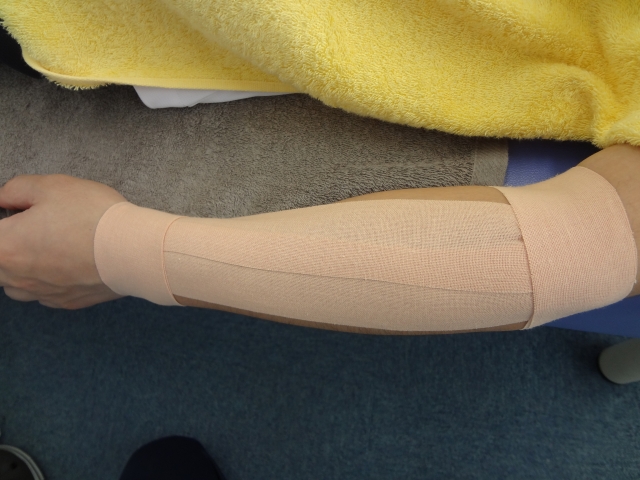 テーピング療法